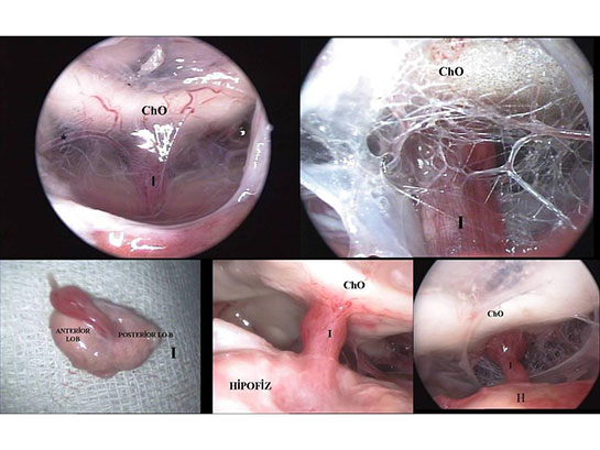 Fsh Hormonu Nedir ve Kaç Olmalıdır?