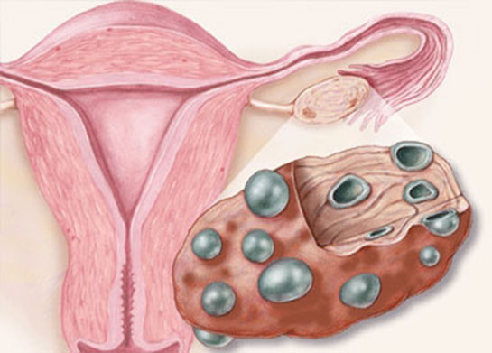 Kadnlarda Testosteron Hormonu